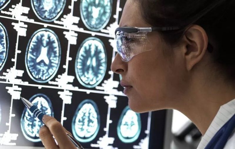 Lajm fantastik! Studiuesit bëjnë zbulimin e shumëpritur, gjendet ilaçi për të trajtuar Alzheimerin