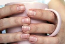 Nëse i vëreni këto ndryshme në thonj, mund të jeni në rrezik