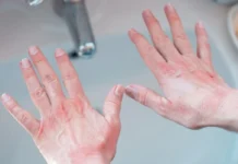 Duart e thata: Një truk menjëherë pas larjes parandalon tharjen