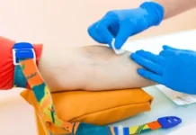 Kur palca e kockave prodhon shumë trombocite: Trombocitemia esenciale dhe mpiksjet e gjakut