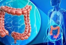 Rreziku i kancerit të zorrës së trashë/ Ja cilat ushqime rrisin riskun e kësaj sëmundjeje