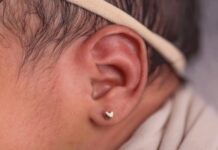 Ja çfarë mund t’i ndodhë foshnjës pas shpimit të veshëve…