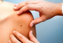 9 simptomat e kancerit që nuk duhet t’i injoroni