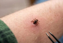 Rriqra nuk transmeton vetëm sëmundjen Lyme: Ja rreziku që na kanoset nga ta