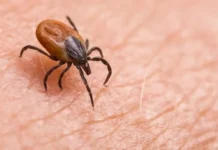 Shenjat që tregojnë se pickimi i një insekti mund të jetë më serioz nga sa duket