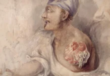 Ushtari i luftës së vitit 1812 varrosi krahun e tij të prerë, por historia e tij e vërtetë është edhe më e çuditshme